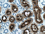 CD13 Antibody in Immunohistochemistry (Paraffin) (IHC (P))