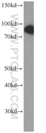 USP5 Antibody in Western Blot (WB)