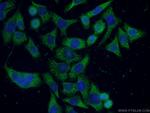 APOD Antibody in Immunocytochemistry (ICC/IF)