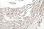 N-cadherin Antibody in Immunohistochemistry (Paraffin) (IHC (P))