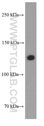 N-cadherin Antibody in Western Blot (WB)