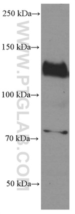 N-cadherin Antibody in Western Blot (WB)