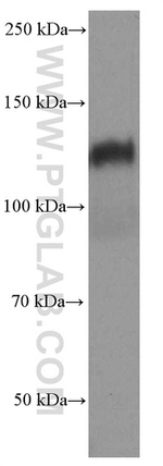 N-cadherin Antibody in Western Blot (WB)