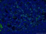 PD-1/CD279 Antibody in Immunohistochemistry (PFA fixed) (IHC (PFA))