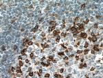 PD-1/CD279 Antibody in Immunohistochemistry (Paraffin) (IHC (P))