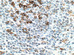 PD-1/CD279 Antibody in Immunohistochemistry (Paraffin) (IHC (P))