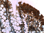 Alpha E catenin Antibody in Immunohistochemistry (Paraffin) (IHC (P))