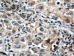 ORAI1 Antibody in Immunohistochemistry (Paraffin) (IHC (P))