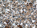 ORAI1 Antibody in Immunohistochemistry (Paraffin) (IHC (P))