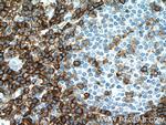 CD43 Antibody in Immunohistochemistry (Paraffin) (IHC (P))