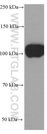 CD43 Antibody in Western Blot (WB)