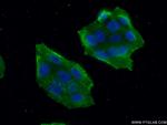 MALT1 Antibody in Immunocytochemistry (ICC/IF)