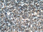 MALT1 Antibody in Immunohistochemistry (Paraffin) (IHC (P))