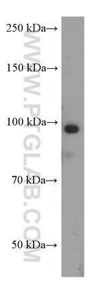 MALT1 Antibody in Western Blot (WB)