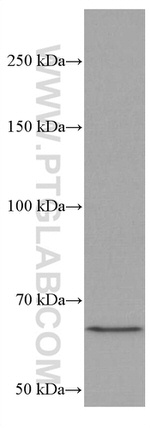 MALT1 Antibody in Western Blot (WB)