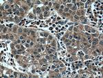 HPSE Antibody in Immunohistochemistry (Paraffin) (IHC (P))