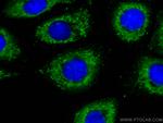 S100A10 Antibody in Immunocytochemistry (ICC/IF)