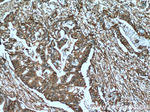 S100A10 Antibody in Immunohistochemistry (Paraffin) (IHC (P))