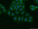 UCHL1 Antibody in Immunocytochemistry (ICC/IF)