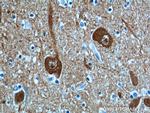 UCHL1 Antibody in Immunohistochemistry (Paraffin) (IHC (P))