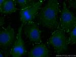 UCHL1 Antibody in Immunocytochemistry (ICC/IF)