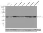 UCHL1 Antibody in Western Blot (WB)