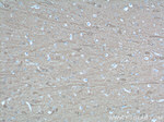 UCHL1 Antibody in Immunohistochemistry (Paraffin) (IHC (P))