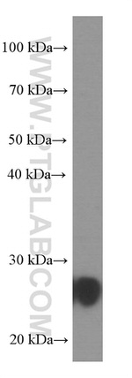 UCHL1 Antibody in Western Blot (WB)