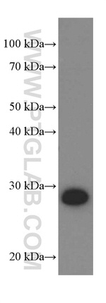 UCHL1 Antibody in Western Blot (WB)