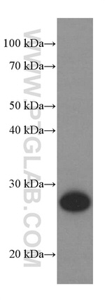 UCHL1 Antibody in Western Blot (WB)