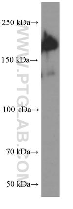 SALL4 Antibody in Western Blot (WB)