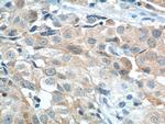 STXBP2 Antibody in Immunohistochemistry (Paraffin) (IHC (P))