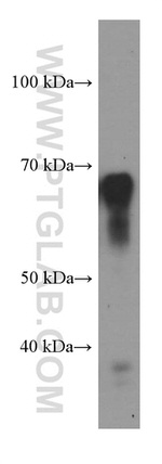 STXBP2 Antibody in Western Blot (WB)