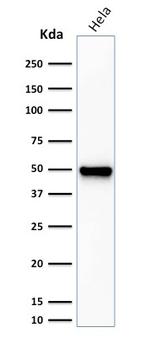 Fascin-1 (Reed-Sternberg Cell Marker) Antibody in Western Blot (WB)