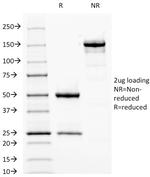 Fascin-1 (Reed-Sternberg Cell Marker) Antibody in SDS-PAGE (SDS-PAGE)