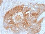 Fascin-1 (Reed-Sternberg Cell Marker) Antibody in Immunohistochemistry (Paraffin) (IHC (P))