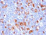 Fascin-1 (Reed-Sternberg Cell Marker) Antibody in Immunohistochemistry (Paraffin) (IHC (P))