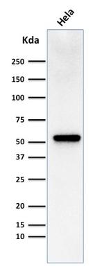 Fascin-1 (Reed-Sternberg Cell Marker) Antibody in Western Blot (WB)