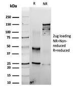 Fascin-1 (Reed-Sternberg Cell Marker) Antibody in Immunoelectrophoresis (IE)