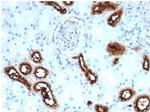 Fascin-1 (Reed-Sternberg Cell Marker) Antibody in Immunohistochemistry (Paraffin) (IHC (P))