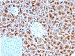 Fascin-1 (Reed-Sternberg Cell Marker) Antibody in Immunohistochemistry (Paraffin) (IHC (P))