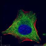 beta Tubulin Antibody in Immunocytochemistry (ICC/IF)