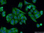 beta Tubulin Antibody in Immunocytochemistry (ICC/IF)