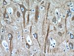 beta Tubulin Antibody in Immunohistochemistry (Paraffin) (IHC (P))