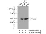 beta Tubulin Antibody in Immunoprecipitation (IP)
