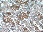 beta Tubulin Antibody in Immunohistochemistry (Paraffin) (IHC (P))