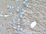 beta Tubulin Antibody in Immunohistochemistry (Paraffin) (IHC (P))