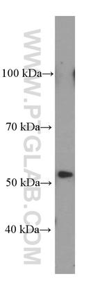 CA9 Antibody in Western Blot (WB)