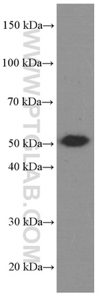 CA9 Antibody in Western Blot (WB)