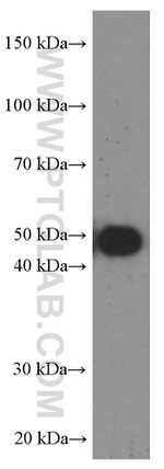 CA9 Antibody in Western Blot (WB)